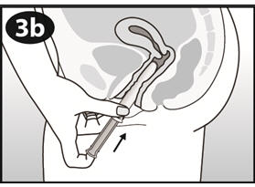 Figure 3b
