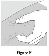 Instructions for Use Figure F