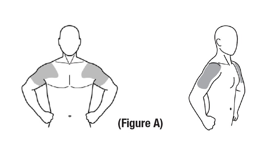 figure-a