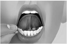 bupr-naloxone-ifu-mouth- image