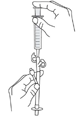 Figure-IFU-14
