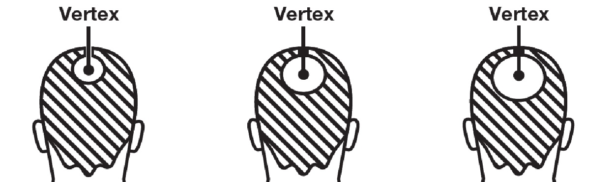 vertex-image.jpg