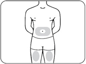 Figure E.1