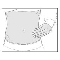 Figure F