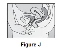 fig-j