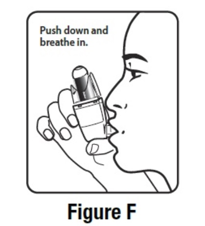 FIGURE F