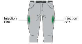 Figure B