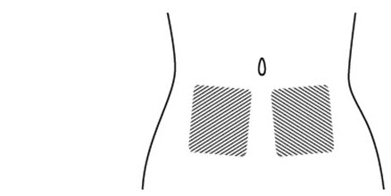 Figure F