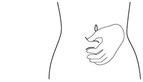 Figure J